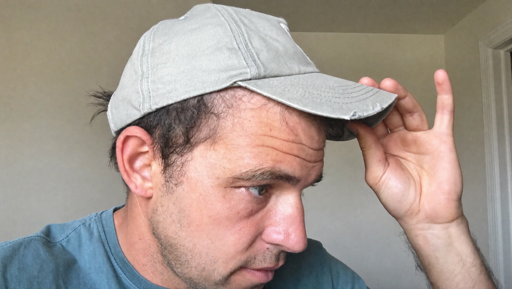A man lifting the brim of his gray baseball cap to inspect his receding hairline.