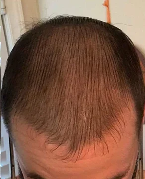 After