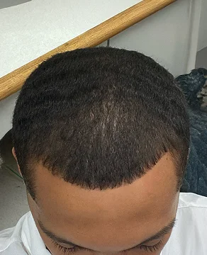 After