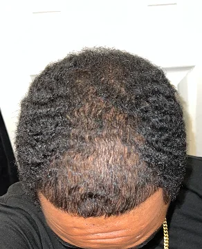 After