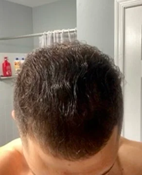 After